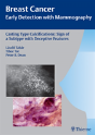 Casting-Type Calcifications: Sign Of A Subtype With Deceptive Features - Preview