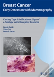 Capa do artigo Casting-Type Calcifications: Sign Of A Subtype With Deceptive Features