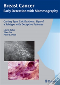 Capa do artigo Casting-Type Calcifications: Sign Of A Subtype With Deceptive Features