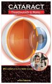 Cataract. Treatment & More