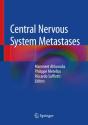 Central Nervous System Metastases - Preview
