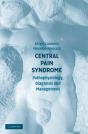 Central Pain Syndrome - Preview