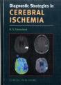 Cerebral Ischemia - Preview
