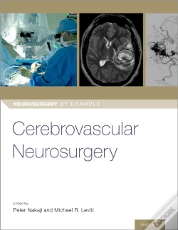 Capa do artigo Cerebrovascular Neurosurgery