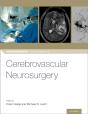 Cerebrovascular Neurosurgery - Preview