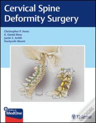 Cervical Spine Deformity Surgery