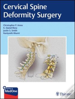 Capa do artigo Cervical Spine Deformity Surgery