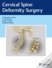 Capa do artigo Cervical Spine Deformity Surgery