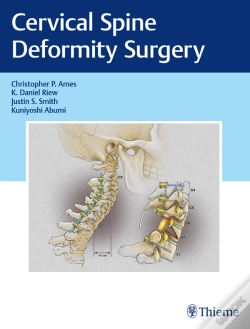 Capa do artigo Cervical Spine Deformity Surgery