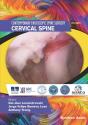 Cervical Spine - Preview
