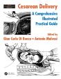 Cesarean Delivery - Preview