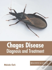 Chagas Disease: Diagnosis And Treatment