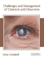Challenges And Management Of Cataracts And Glaucoma - Preview