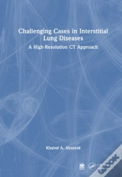 Capa do artigo Challenging Cases In Interstitial Lung Diseases