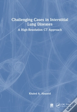 Capa do artigo Challenging Cases In Interstitial Lung Diseases