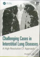 Challenging Cases In Interstitial Lung Diseases