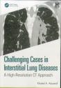 Challenging Cases In Interstitial Lung Diseases - Preview