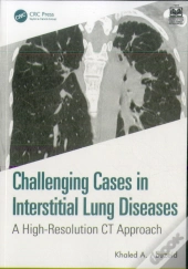Challenging Cases In Interstitial Lung Diseases