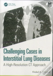 Capa do artigo Challenging Cases In Interstitial Lung Diseases