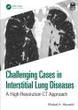 Challenging Cases In Interstitial Lung Diseases - Preview