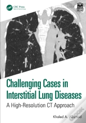 Capa do artigo Challenging Cases In Interstitial Lung Diseases