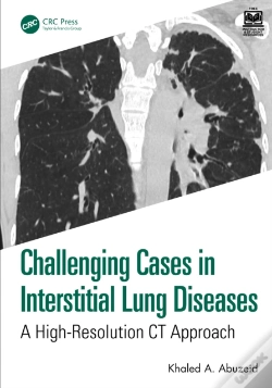 Capa do artigo Challenging Cases In Interstitial Lung Diseases