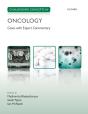 Challenging Concepts In Oncology - Preview