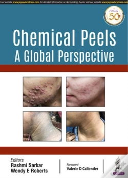 Capa do artigo Chemical Peels: A Global Perspective