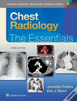 Capa do artigo Chest Radiology: The Essentials