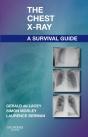 Chest X-Ray: A Survival Guide - Preview