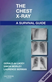 Capa do artigo Chest X-Ray: A Survival Guide