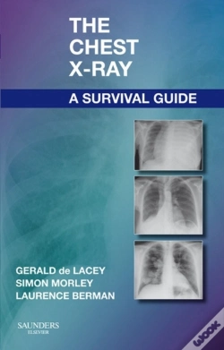 Capa do artigo Chest X-Ray: A Survival Guide