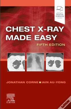 Capa do artigo Chest X-Ray Made Easy E-Book
