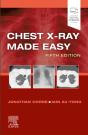 Chest X-Ray Made Easy E-Book - Preview