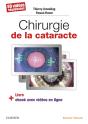 Chirurgie De La Cataracte ; 80 Vidéos Séquencées - Preview