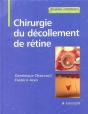 Chirurgie Du Décollement De Retine - Preview