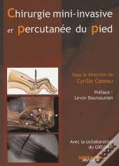 Chirurgie Mini Invasive Et Percutanée Du Pied