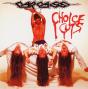 Choice Cuts - Vinil - Preview