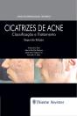 Cicatrizes De Acne - Preview