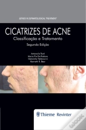 Capa do artigo Cicatrizes De Acne