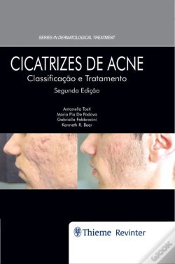 Capa do artigo Cicatrizes De Acne