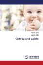Cleft Lip And Palate - Preview