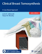 Capa do artigo Clinical Breast Tomosynthesis