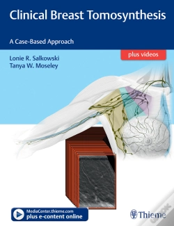 Capa do artigo Clinical Breast Tomosynthesis
