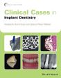 Clinical Cases In Implant Dentistry - Preview