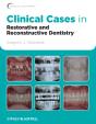 Clinical Cases In Restorative And Reconstructive Dentistry - Preview