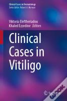 Clinical Cases In Vitiligo