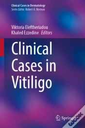 Capa do artigo Clinical Cases In Vitiligo