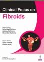 Clinical Focus On Fibroids - Preview