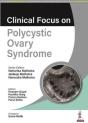 Clinical Focus On Polycystic Ovary Syndrome - Preview